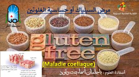 مرض السيلياك أو حساسية الغلوتين